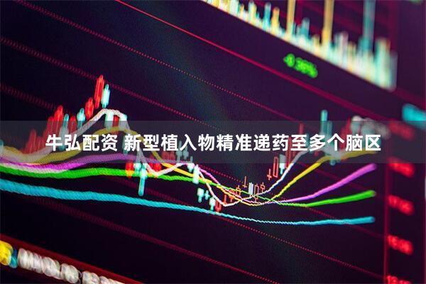 牛弘配资 新型植入物精准递药至多个脑区
